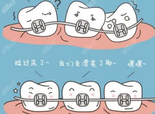 矫正牙齿是否会对牙齿造成损害？了解真相！