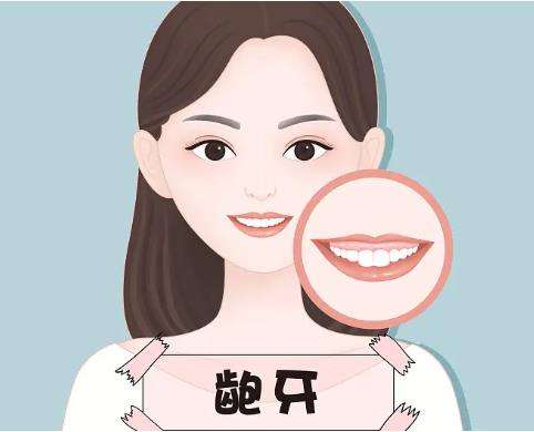 龅牙1.jpg